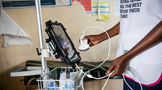 L'échographie guidée par l'IA a été formée à partir de données échographiques.